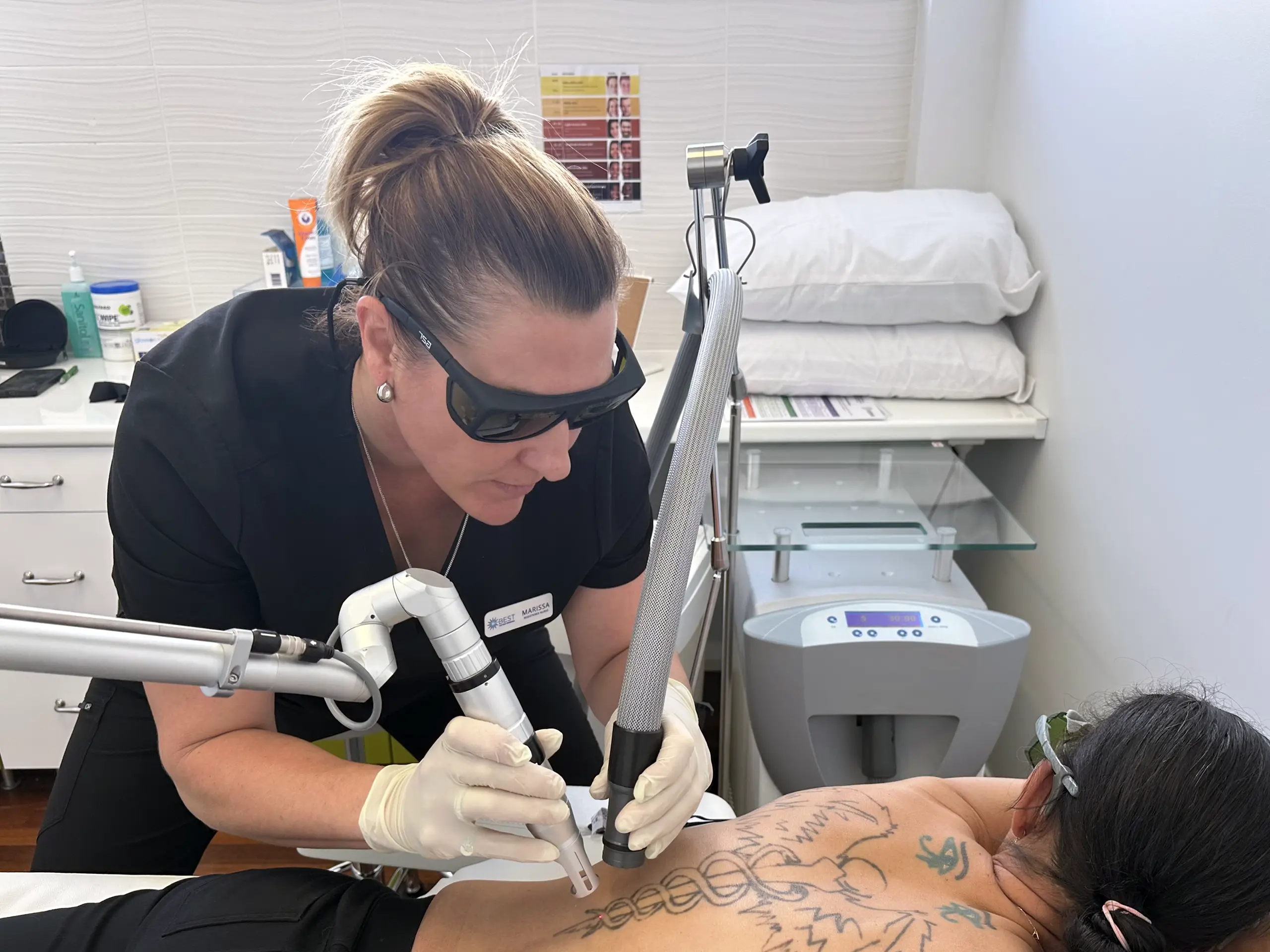 Nurse performing laser tattoo removal on a back tattoo, Perth